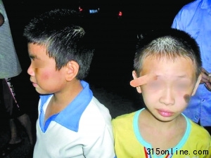 8歲學(xué)生稱遭老師扇耳光致眉角開裂皮肉外翻(圖)