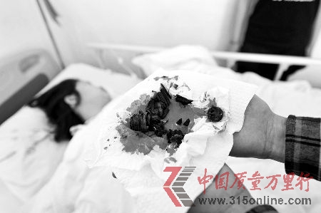 經(jīng)過搶救后,女子脫離了生命危險,但依然非常虛弱,連說話的力氣也沒有。醫(yī)生在手術(shù)中,從該女子體內(nèi)取出一二十塊碎片,其中包括鐵環(huán)、螺絲和大塑料塊等,觸目驚心。 CFP 經(jīng)過搶救后,女子脫離了生命危險,但依然非常虛弱,連說話的力氣也沒有。醫(yī)生在手術(shù)中,從該女子體內(nèi)取出一二十塊碎片,其中包括鐵環(huán)、螺絲和大塑料塊等,觸目驚心。 CFP